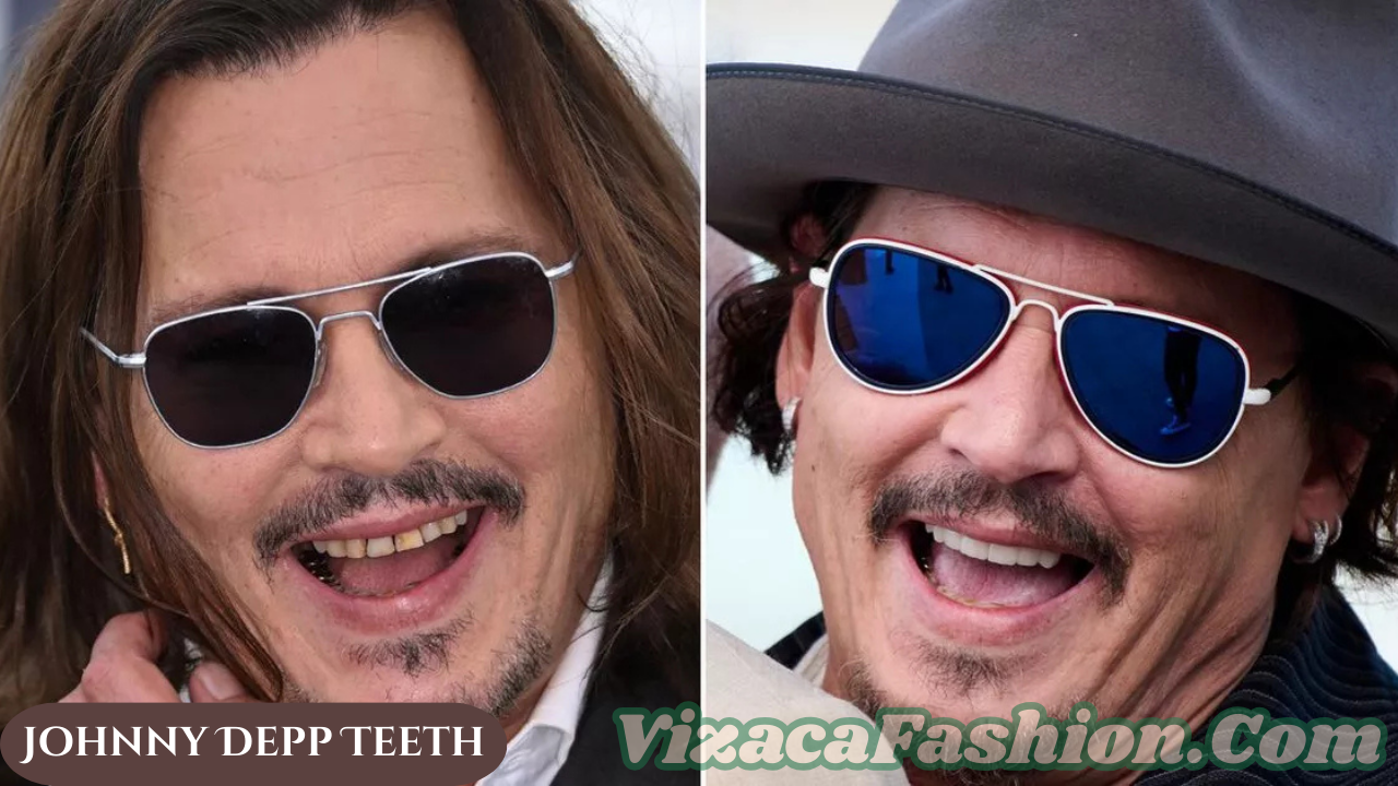 Johnny Depp Teeth